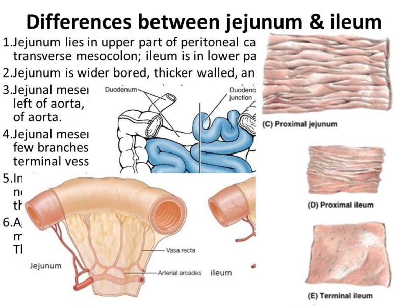 11 Diferencia crucial entre yeyuno e íleon con tabla