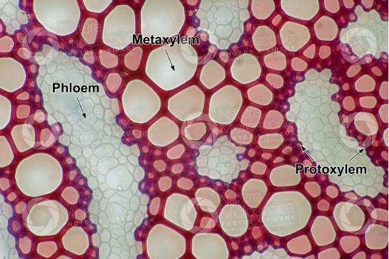 15 Principales diferencias entre protoxylem y metaxylem con tabla