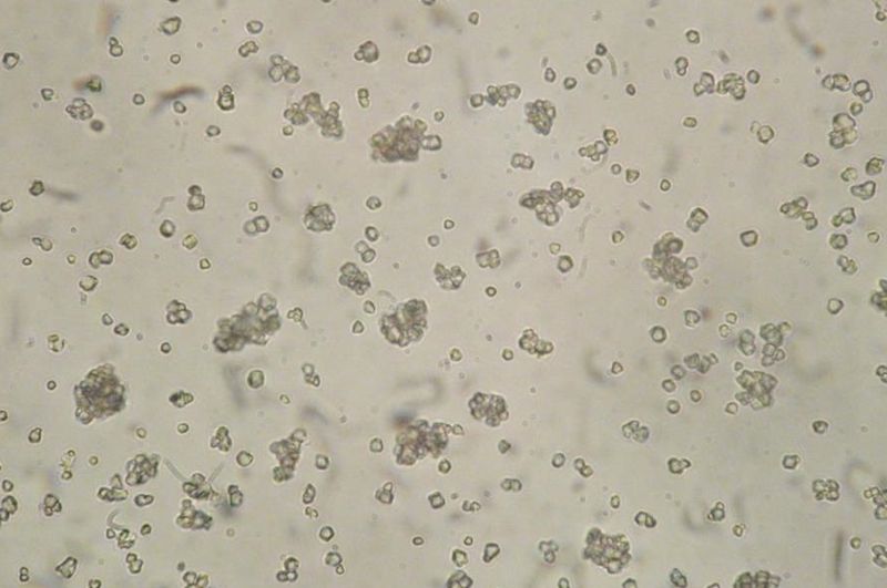 Diferencia entre celulosa, almidón y glucógeno