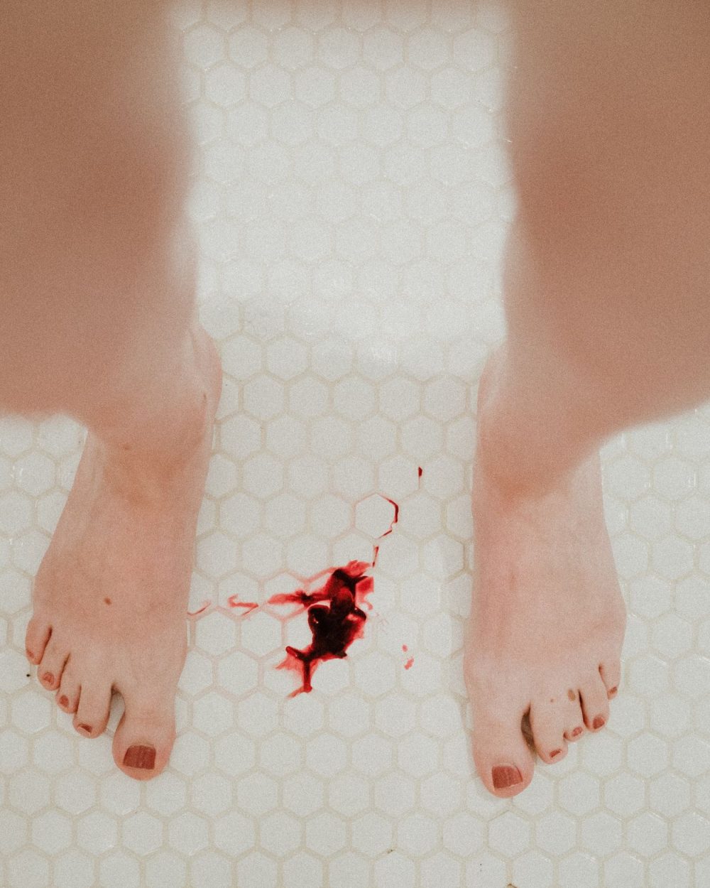 una persona sangrando