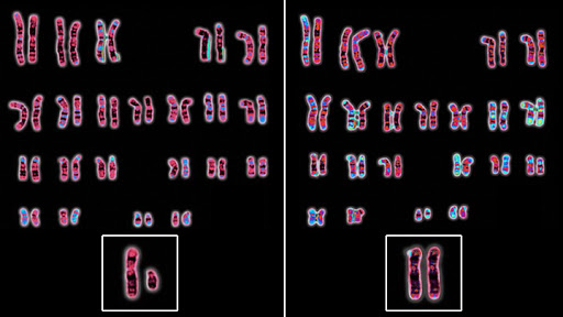 7 diferencias notables entre los cromosomas X e Y