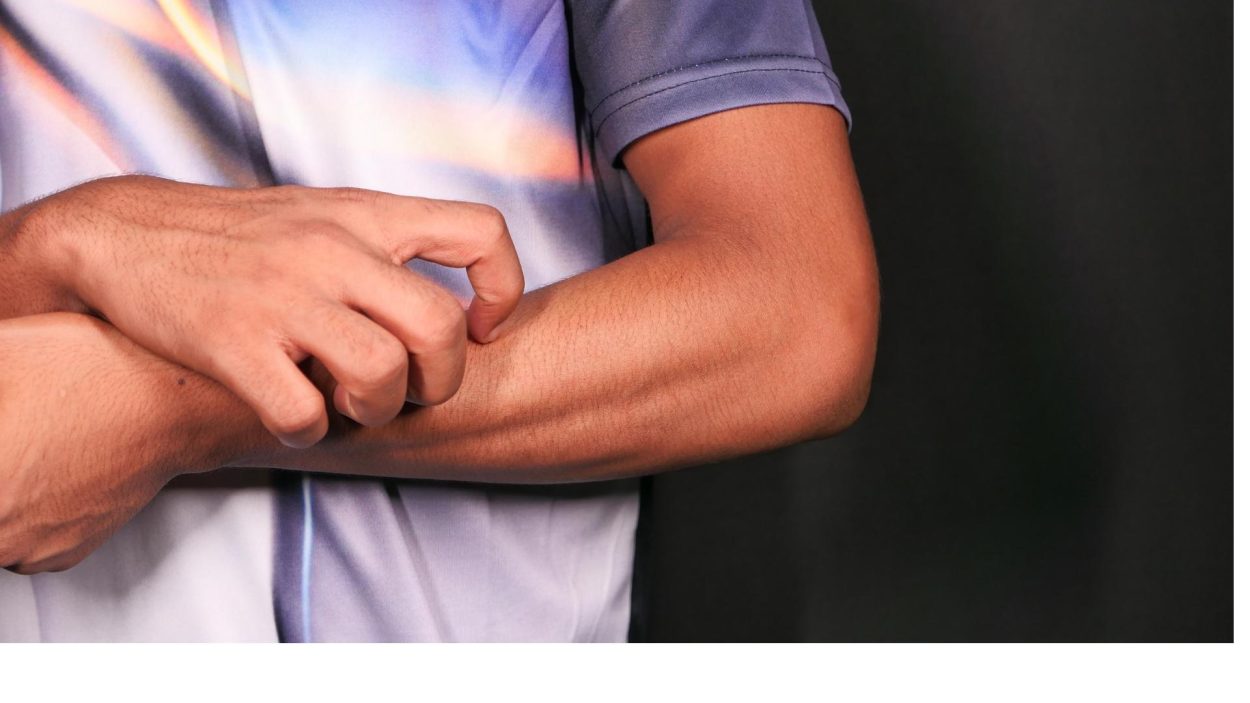 Una persona rascándose el brazo.