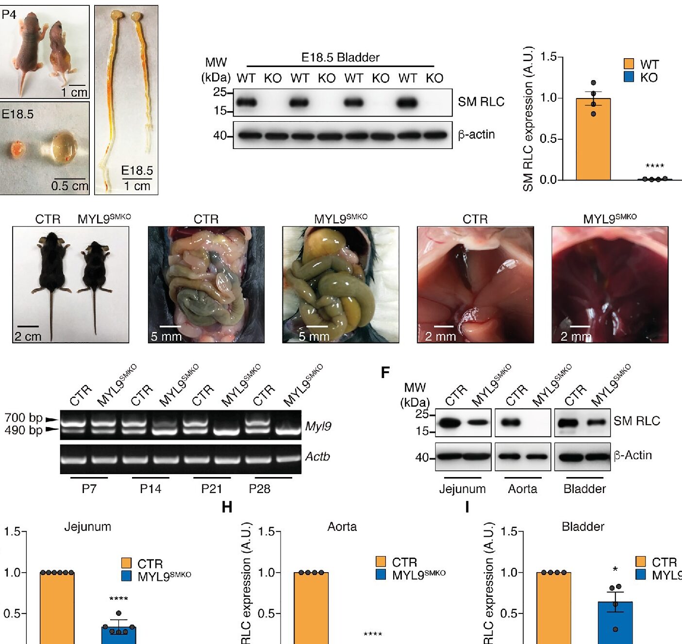 10 diferencias entre actina y miosina con similitudes
