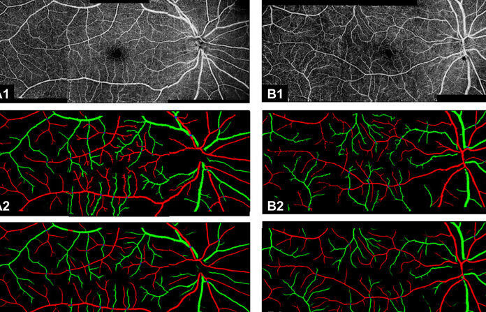 29 Diferencia entre Arterias y Venas (Con Tabla)