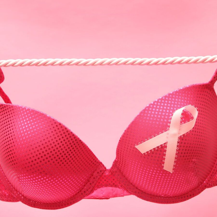 Diferencia entre arrugas y hoyuelos en el cáncer de mama (explicado): todas las diferencias Diferencia entre arrugas y hoyuelos en el cáncer de mama (explicado): todas las diferencias