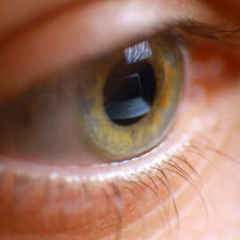 Diferencia entre hipnosis e hipnoterapia Diferencia entre hipnosis e hipnoterapia